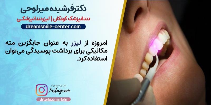 عصب کشی دندان با لیزر|دکتر فرشیده میرلوحی