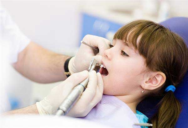 فلوراید تراپی دندان کودکان
