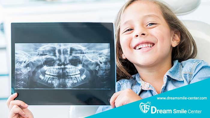 رادیوگرافی دندان کودکان