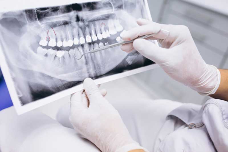 مراقبت های لازم برای مراجعه به دندانپزشکی در دوران بارداری
