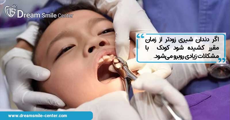 کشیدن زودتر از موعد دندان شیری