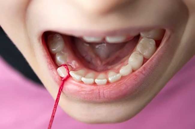 کشیدن دندان شیری کودک
