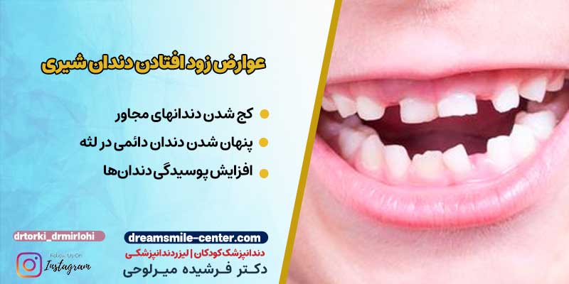 عوارض زود افتادن دندان شیری | دکترفرشیده میرلوحی دندانپزشک کودکان