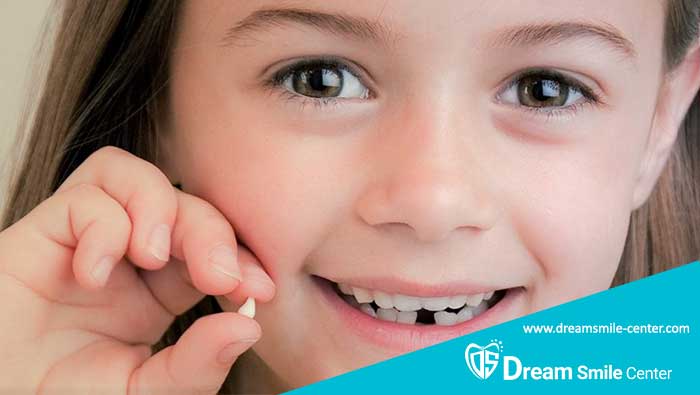 علت زود افتادن دندان شیری یا ریزش دندان