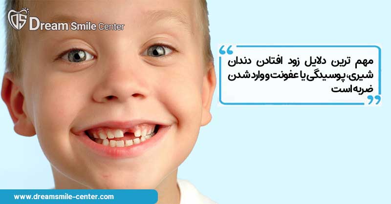 مهم ترین دلایل زود افتادن دندان شیری