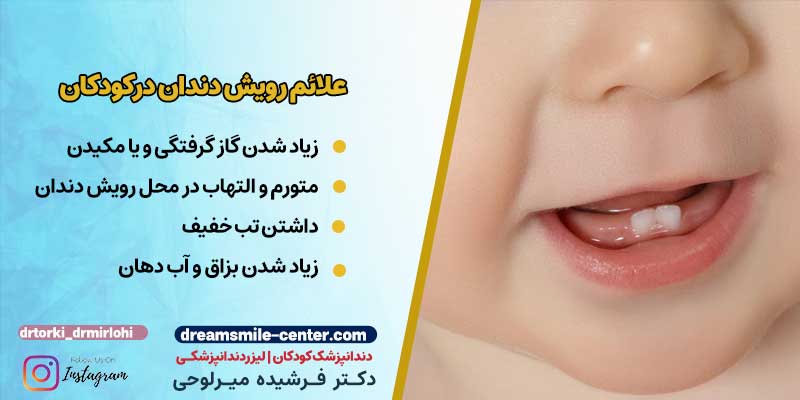 علائم رویش دندان شیری در کودکان | دکترفرشیده میرلوحی دندانپزشک کودکان