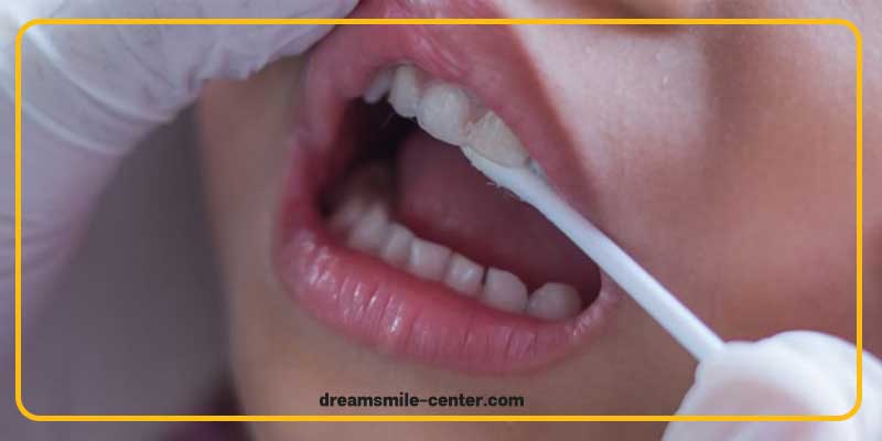 Dental fluoride therapy for children