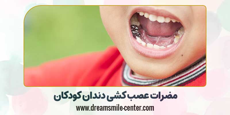 مضرات عصب کشی دندان کودکان | دکترفرشیده میرلوحی دندانپزشک کودکان