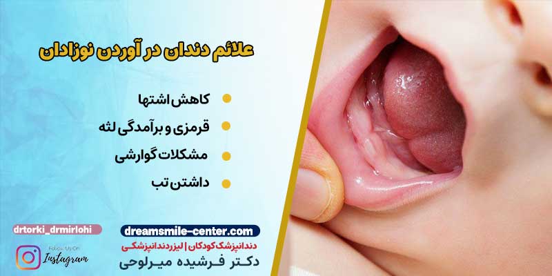 علائم دندان در اوردن کودکان | دکترفرشیده میرلوحی دندانپزشک کودکان