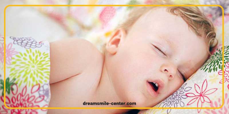 علت نفس کشیدن کودک از دهان