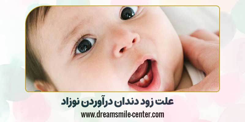 علت زود دندان درآوردن نوزاد |دکترفرشیده میرلوحی دندانپزشک کودکان