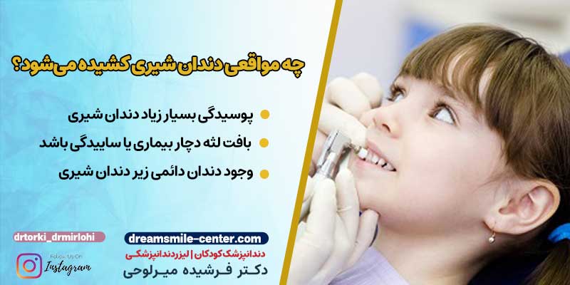 کشیدن دندان شیری کودکان | دکترفرشیده میرلوحی دندانپزشک کودکان