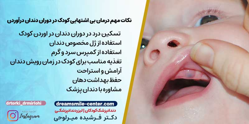 نکات مهم درمان بی اشتهایی کودک در دوران دندان درآوردن