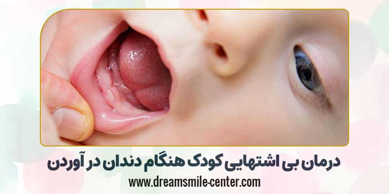 درمان بی اشتهایی کودک هنگام دندان در آوردن